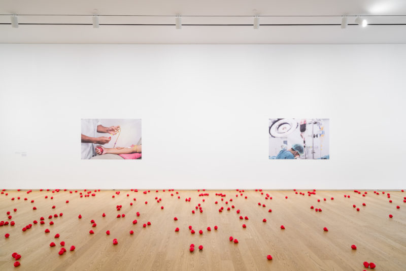 Two photos are hung on a white wall, to the left the image pictures a medical professional preparing an arm for an injection. To the right a medical professional stands beneath a surgical lamp, with a blood bag hanging in the foreground.